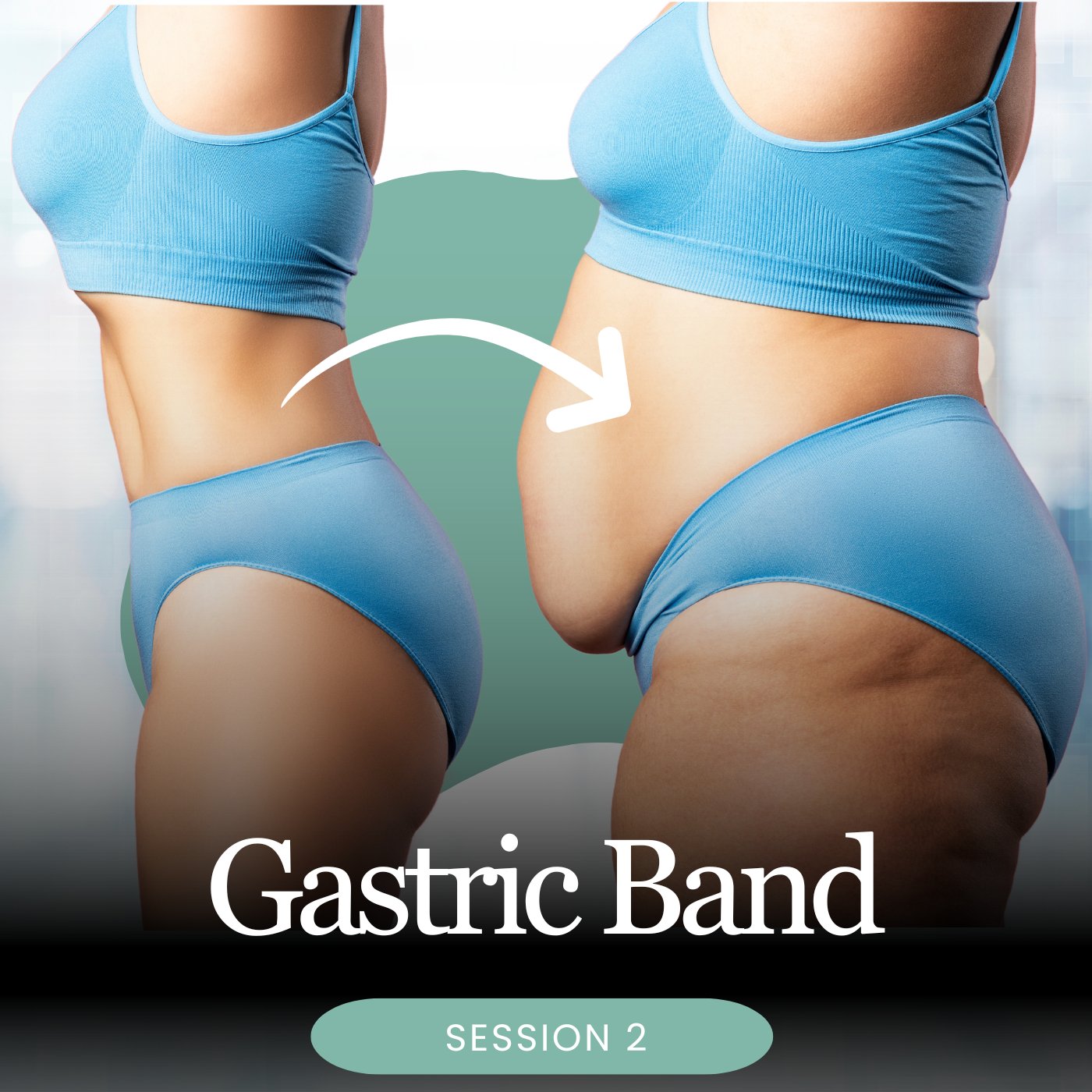 Hypnotic Gastric Band 3 Week Package - Clearmindshypnotherapy